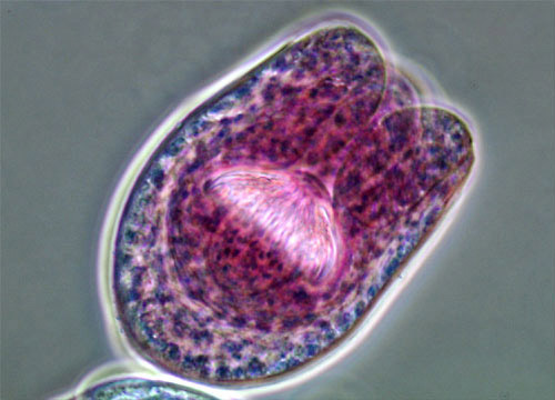 Tapeworm Echinococcus granulosus Hydatid Cyst | Nikon’s MicroscopyU