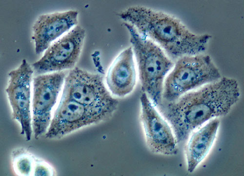 HeLa Cell Culture | Nikon’s MicroscopyU