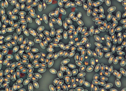 Frog Blood Cells | Nikon’s MicroscopyU