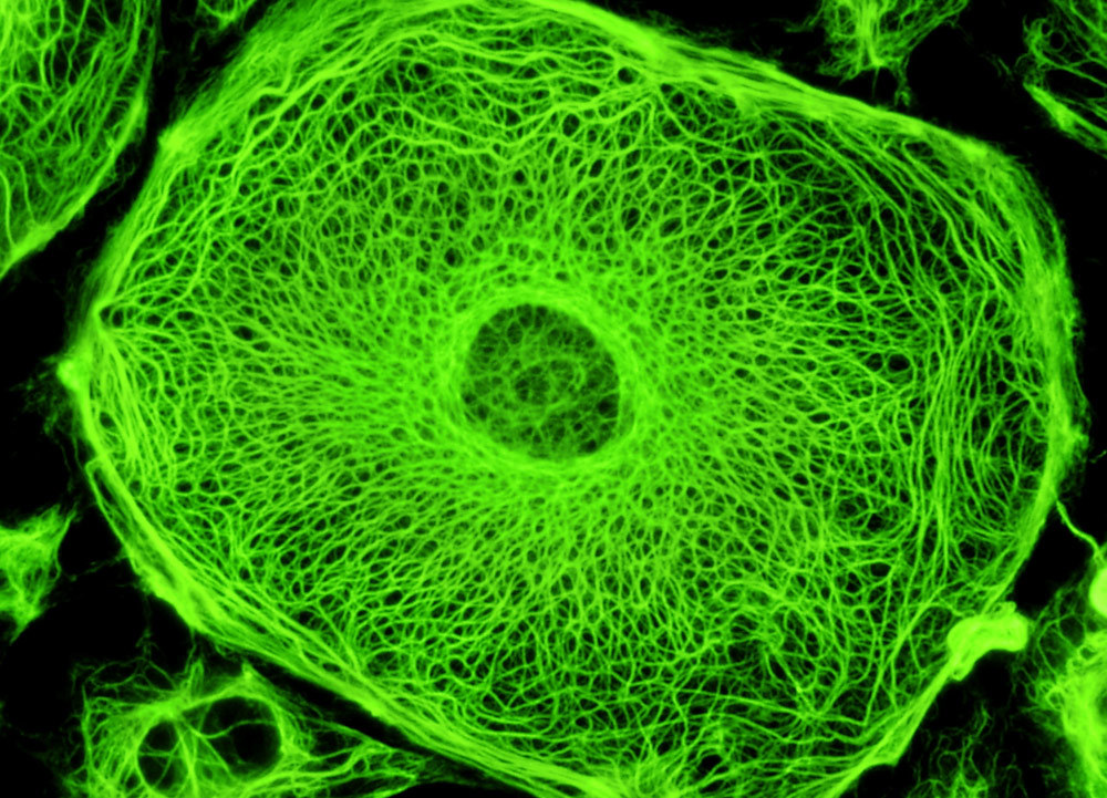 Vaizdo rezultatas pagal užklausą „cell filaments“