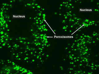 Swept Field Confocal Microscopy Video Gallery | Nikon’s MicroscopyU
