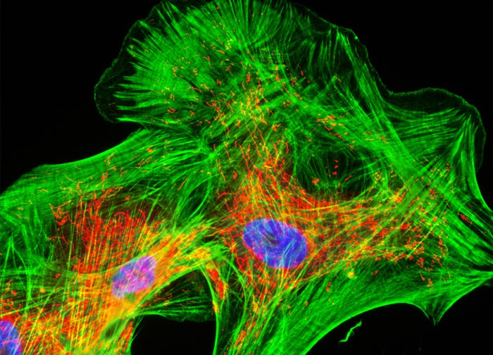 larynx unit area Human Cortical Neuronal Cells (HCN-1A Line) | Nikon's MicroscopyU