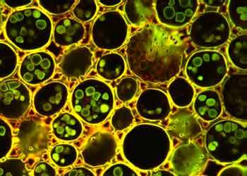 Oak Tree Stem | Nikon’s MicroscopyU