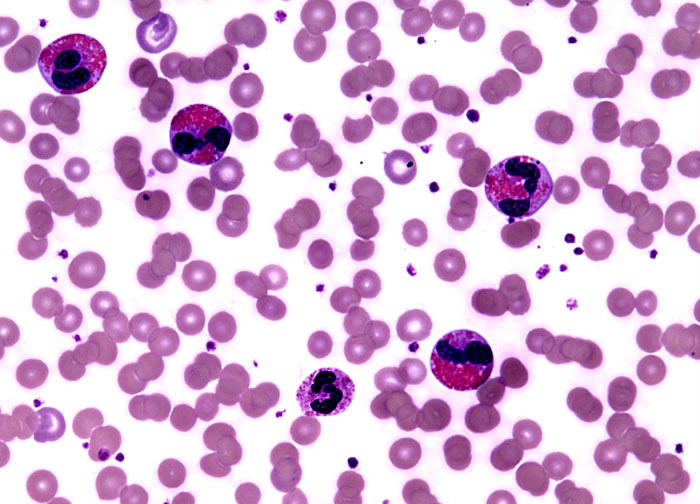 Eosinophil Under Light Microscope Eosinophil Under Light Microscope