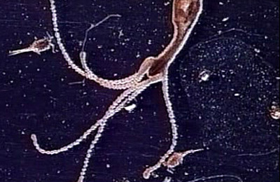 Hydra (Coelenterata) Videos | Nikon's MicroscopyU Hydra (Coelenterata) Videos | Nikon's MicroscopyU