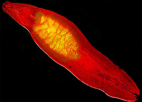 Human Liver Fluke  Nikon's MicroscopyU